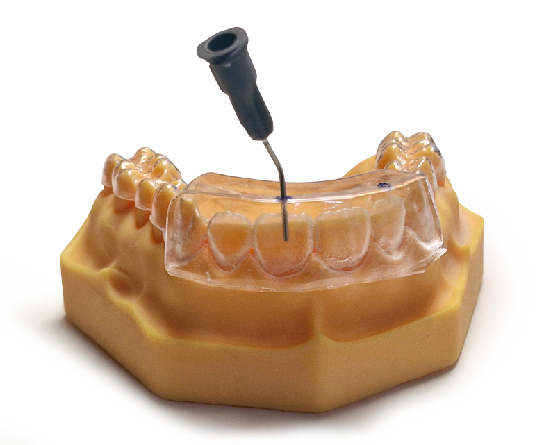 Immagini di una dentiera