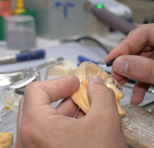 Foto di una persona che sta lavorando su una dentiera